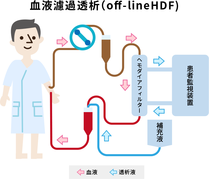 血液透析(HD)